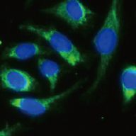 IF_Hela cell