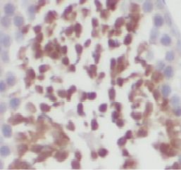 IHC_mouse testes