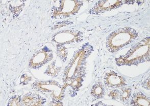FineTest® Poly-HRP secondary antibody, DAB staining for 1min.