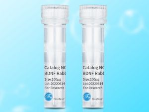 FineTest Antibody