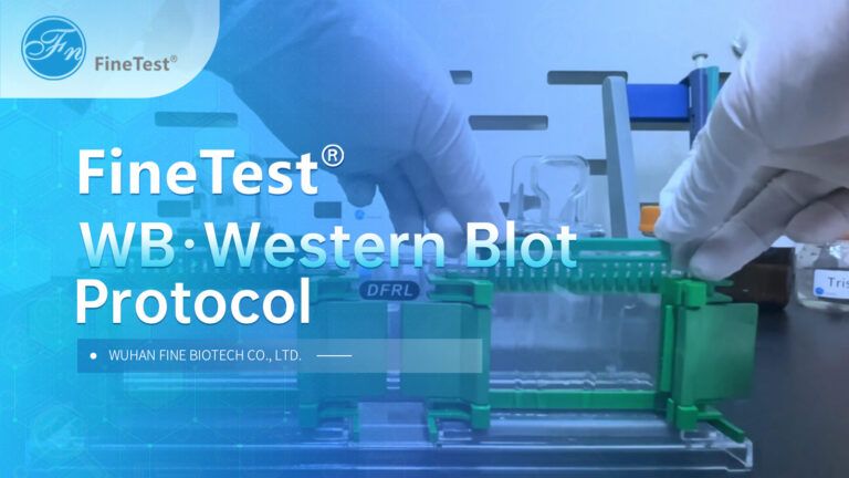 Western Blot Step by Step